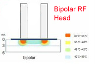 Economic Elight (IPL +RF) +Bipolar RF Machine IPL Beauty Equipment