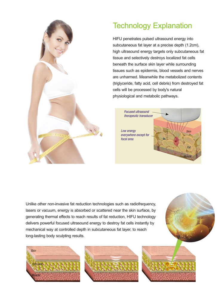 2016 Best Slimming Technology Liposunic Slimming  Hifu Beauty Machine